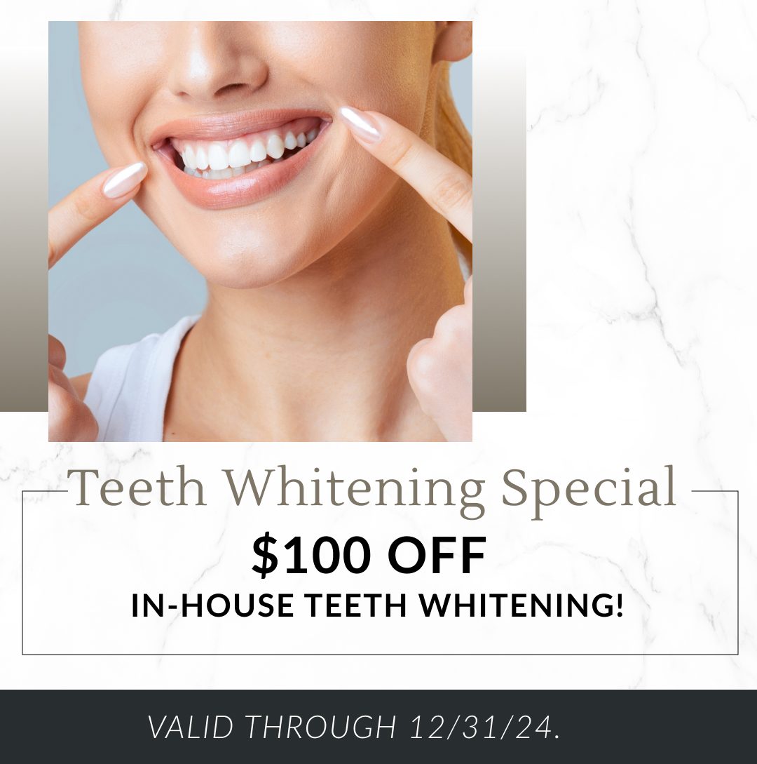 $100 off In-House Teeth Whitening